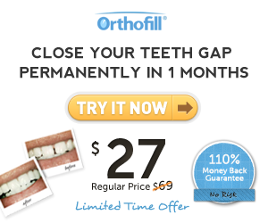  gaps in teeth